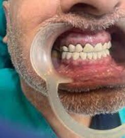  Tender Care Dental